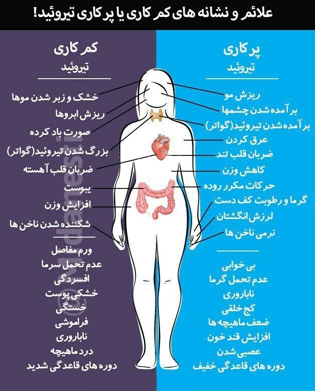 باتوجه به علائم و نشانه های گفته شده در بالا میتوانید تشخیص دهید که آیا تیروئید کم کار، پر کار و یا نرمال دارید ( ☝ )