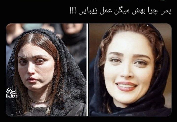تصویری از بهنوش طباطبایی قبل و بعد از "عمل های" زیبایی که مورد توجه کاربران قرارگرفته