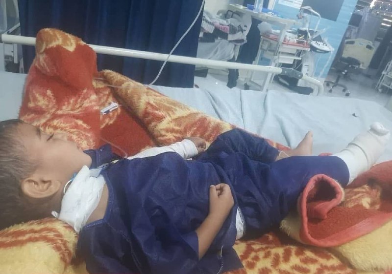 Child injured in attack on Allah Akbar Hill neighborhood of Bandar Abbas