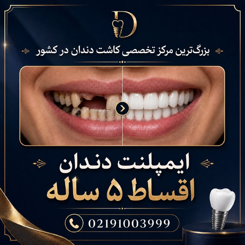 🦷 ✨ وقتی قرار است ایمپلنت انجام دهید، فقط قیمت مهم نیست؛ اعتماد مهمتر است
