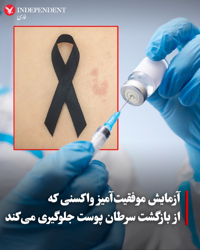 مودرنا و مرک: واکسن mRNA برای درمان ملانوما در آزمایش بالینی