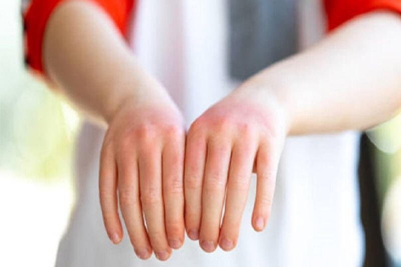 Ahvaz Jundishapur University of Medical Sciences Member Explained Hidden Rheumatism