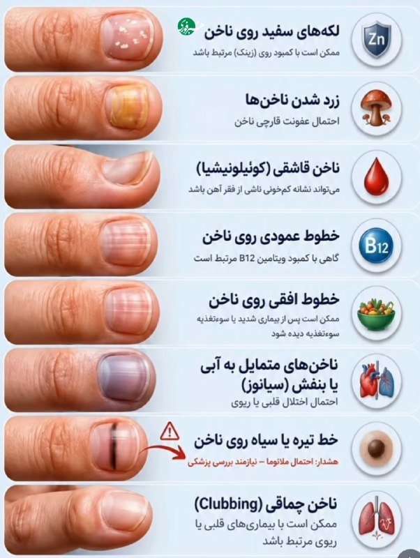 Know the meaning of spots and lines on nails