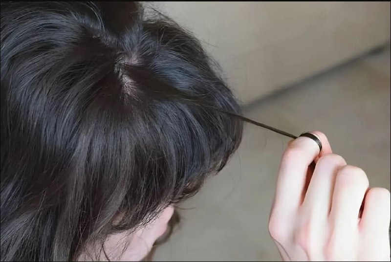 چرا برخی افراد موهای خود را میکنند؟