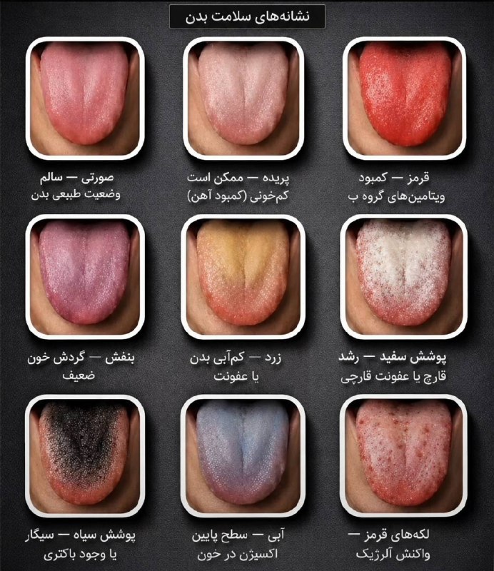 زبان شما اطلاعات زیادی رو دربارهی وضعیت سلامتی شما بیان میکنه